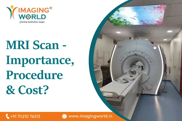 Everything You Should Know About MRI Scan